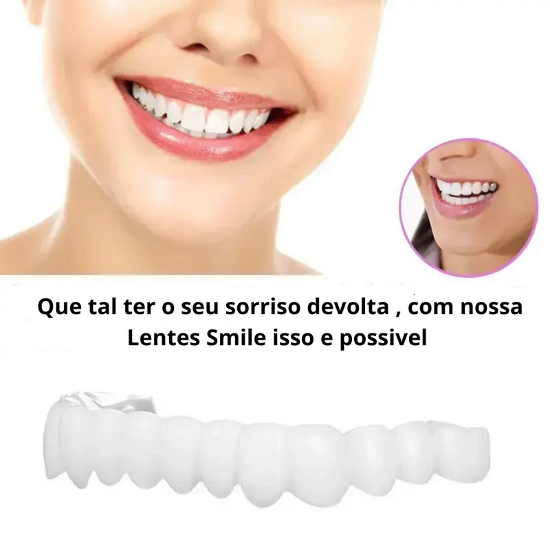 [ 🔥 BRECK FRIDAY 🔥 ] Lente Smile Odontológicas Removíveis - Resina 3M™ Fil Tek™