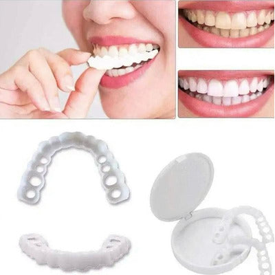 [ 🔥 BRECK FRIDAY 🔥 ] Lente Smile Odontológicas Removíveis - Resina 3M™ Fil Tek™