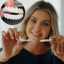 [ 🔥 BRECK FRIDAY 🔥 ] Lente Smile Odontológicas Removíveis - Resina 3M™ Fil Tek™